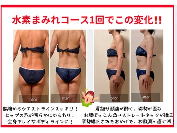 ヨサパーク セルヴィ(YOSA PARK セル美)/★水素まみれコースで爆速痩せ！