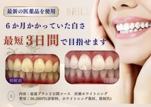 ブリエ(BRILLER)