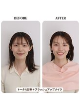 シュアリー(Surely)/トータルコースお客様事例