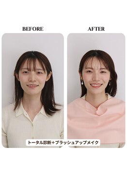 シュアリー(Surely)/トータルコースお客様事例