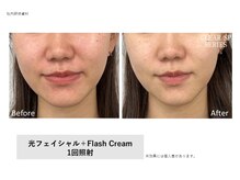 シズク ビューティーサロン(SHIZUKU beauty salon )/