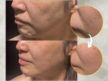 ヴィナーレ(VINARE)