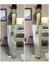 スマイル(smile)/before after 