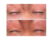 エクリュ(ecru)の雰囲気（一度のお手入れで目元ふっくら！）