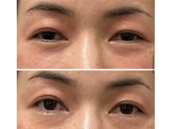 ドクターボディクリスタル(Dr.Body Crystal)/40代後半