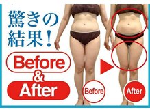 サロンド ローズ(Salon de Rose)