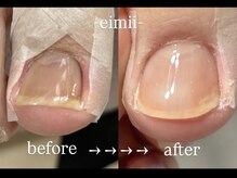 エイミー(eimii)の雰囲気（巻き爪でお悩みの方/ジェルネイルで巻き爪ケア/ヘイスイッチ導入）