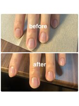 メンズネイルビズ 赤坂(Men's Nail Biz)/MOIST　PRO｜温熱密封リペア