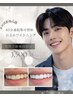 【メンズ限定★純白歯で第一印象強化！】人気No.1!40分間連続集中照射¥3,500