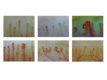 きっと整体院/検査結果：血管の状態確認