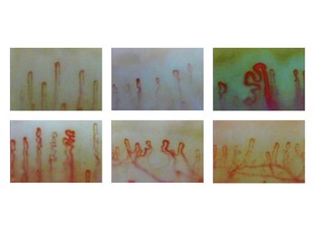 きっと整体院/検査結果：血管の状態確認