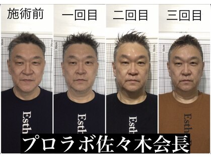 自然美人の写真