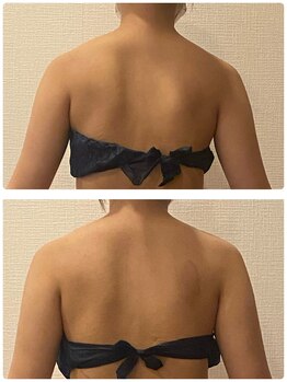 うつくし痩身 美サロン ゼットワン(Z-ONE)の写真/つらい首・肩こりに！筋膜リリースでガチガチの身体をじっくりほぐし、浮腫み/コリ/疲れを解消◎5,800円