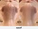ナルムフェイシャル 代々木(NARUM facial)の写真/【新宿/代々木/北参道】毛穴洗浄・毛穴ケア・ピーリングが得意なフェイシャルエステ