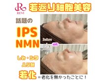 クリア(Clear)の雰囲気（しみ・シワ改善！ハリ艶UP！IPS細胞導入！18,000円）