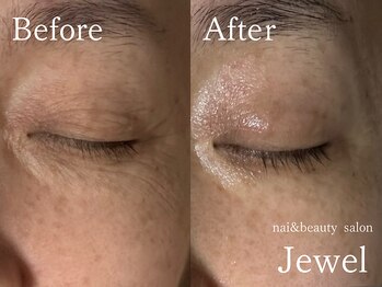 ジュエル(Jewel)/マグマハーブ一回の効果