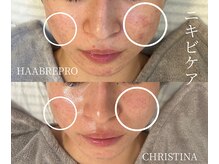 シェア(share.)/繰り返すお悩みに！！