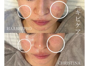 シェア(share.)/繰り返すお悩みに！！