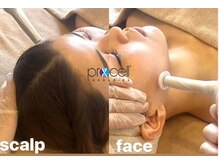 ミレット(Miretto)の雰囲気(深いお悩みにはマイクロニードル!毛穴開き/凹凸/エイジングケア)