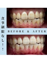 ドルチェ 水戸店(Dolce)/★ before → after ★