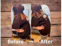 整体院プリュ/Before→ After［5］