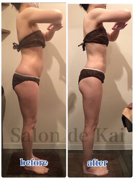 サロンドカイ(Salon de Kai)/ハイブリッドダイエット1か月
