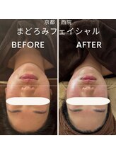 五善アロマ/フェイスラインがすっきり小顔に