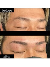 ユー 千葉駅前店(you)/症例写真