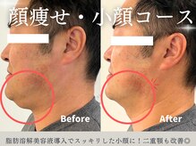 ピュア 川越店の雰囲気（脂肪分解美容液と小顔矯正でスッキリとした小顔へ。）