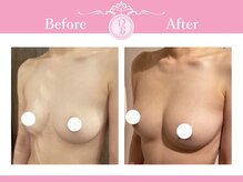 デミーナ(Demyna)の雰囲気（熟練のバストケア★育乳★脱いでも自信のあるバストへ導きます♪）