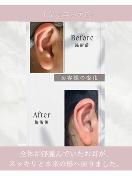 ミミすや(mimiすや)/施術後の変化