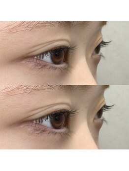 イルム ビューティー アンド ライフ(iLM beauty and life)/まつげパーマ