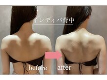 ナルシス(Narcissus)/ブライダルケア