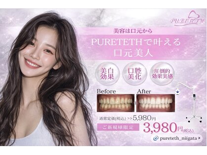 ピュアティス(PURETETH)の写真