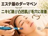  エステ版のソフトダーマ【小顔/毛穴//凸凹肌徹底改善】ダウンタイムなし