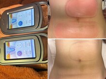 リフュージュ 隠れ家の雰囲気（結果重視の方にこそおすすめ！脂肪冷却☆まずはクーポンで体験！）