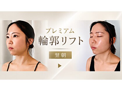 サロンペルレ(salon perle)の写真