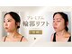サロンペルレ(salon perle)の写真