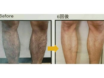 リヤン デコール 鶴ヶ島店(Lien decor)/