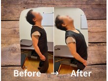 整体院プリュ/Before→ After［4］