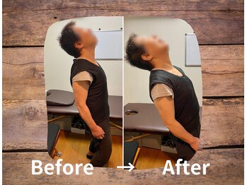 整体院プリュ/Before→ After［4］