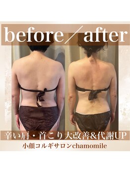 カモミール(chamomile)/BeforeAfter