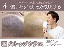 つるピカ 新宿店/4 国内トップクラスのハイパワー