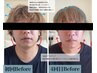 【歪み/エラ】小顔ヘッドスパ＋お顔ほぐし60分◎むくみ/二重アゴ/たるみケア