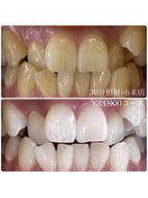 ホワイトニングルーム 横浜店(Whitening Room)/ホワイトニングサロン横浜