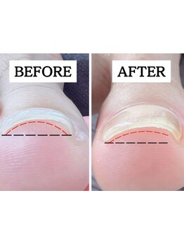 フットネイルがおすすめのサロン