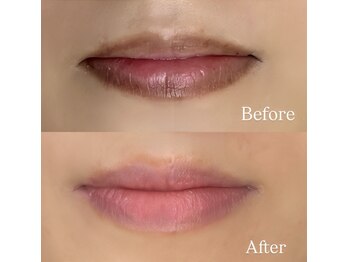 シェリー(Cherie)/ローマピンク 唇