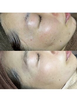 ホワラ 横浜店(Whila)/施術効果１0