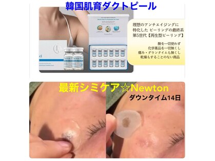 ティンガーラ(TINGARA)の写真
