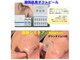 ティンガーラ(TINGARA)の写真
